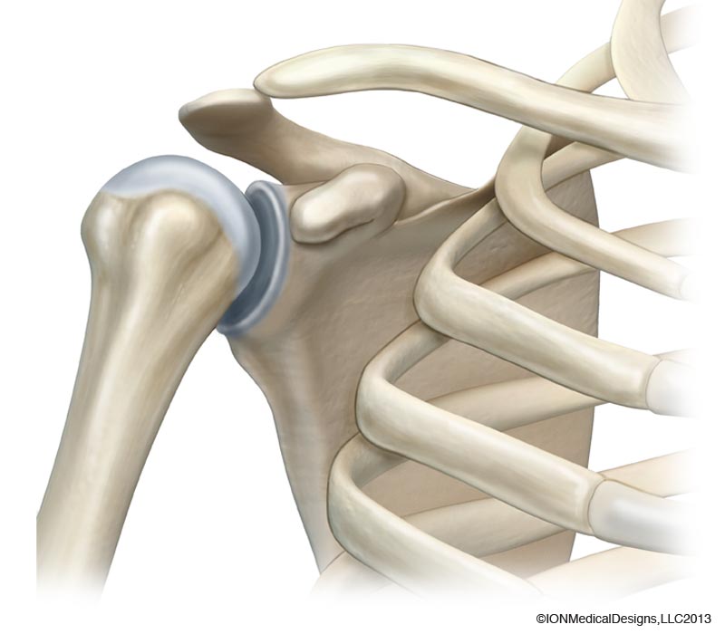 Shoulder Bones - Joint Preservation Center